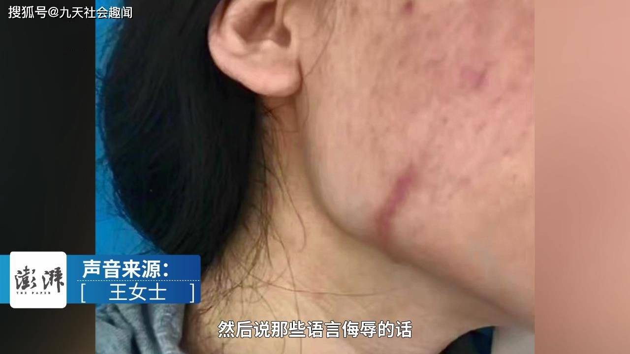 闺蜜疤痕妊娠背后的故事与警示反思