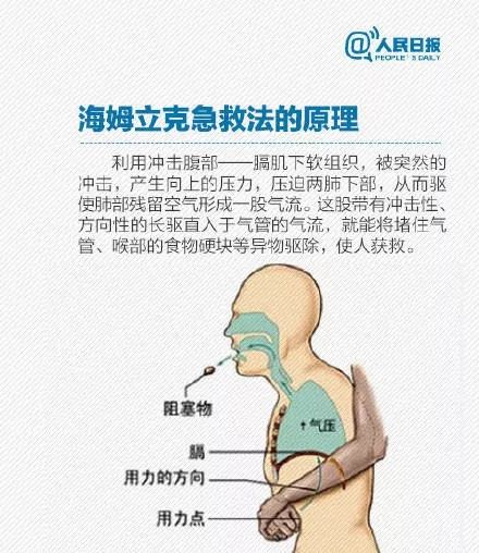 老人吞肉丸窒息离世引发深度思考，责任与安全的考量