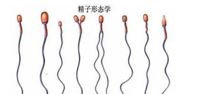 男子精子畸形率高达98%，成因、影响及应对之策