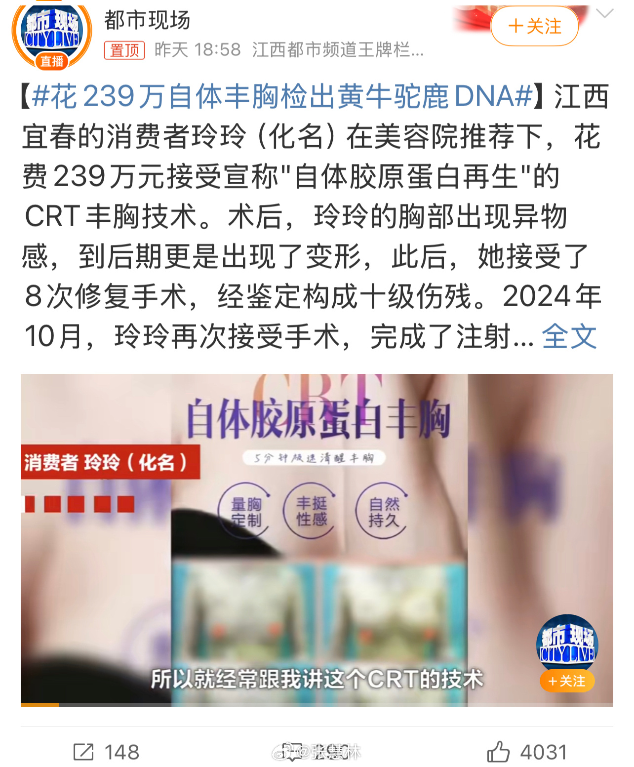 花239万自体丰胸检出黄牛驼鹿DNA